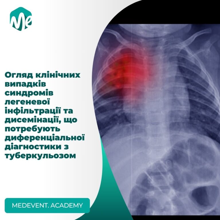 Огляд клінічних випадків синдромів легеневої