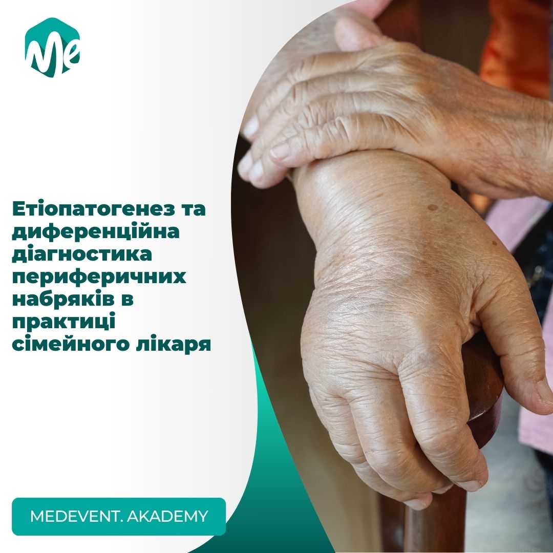 Етіопатогенез та диференційна діагностика периферичних набряків в практиці сімейного лікаря