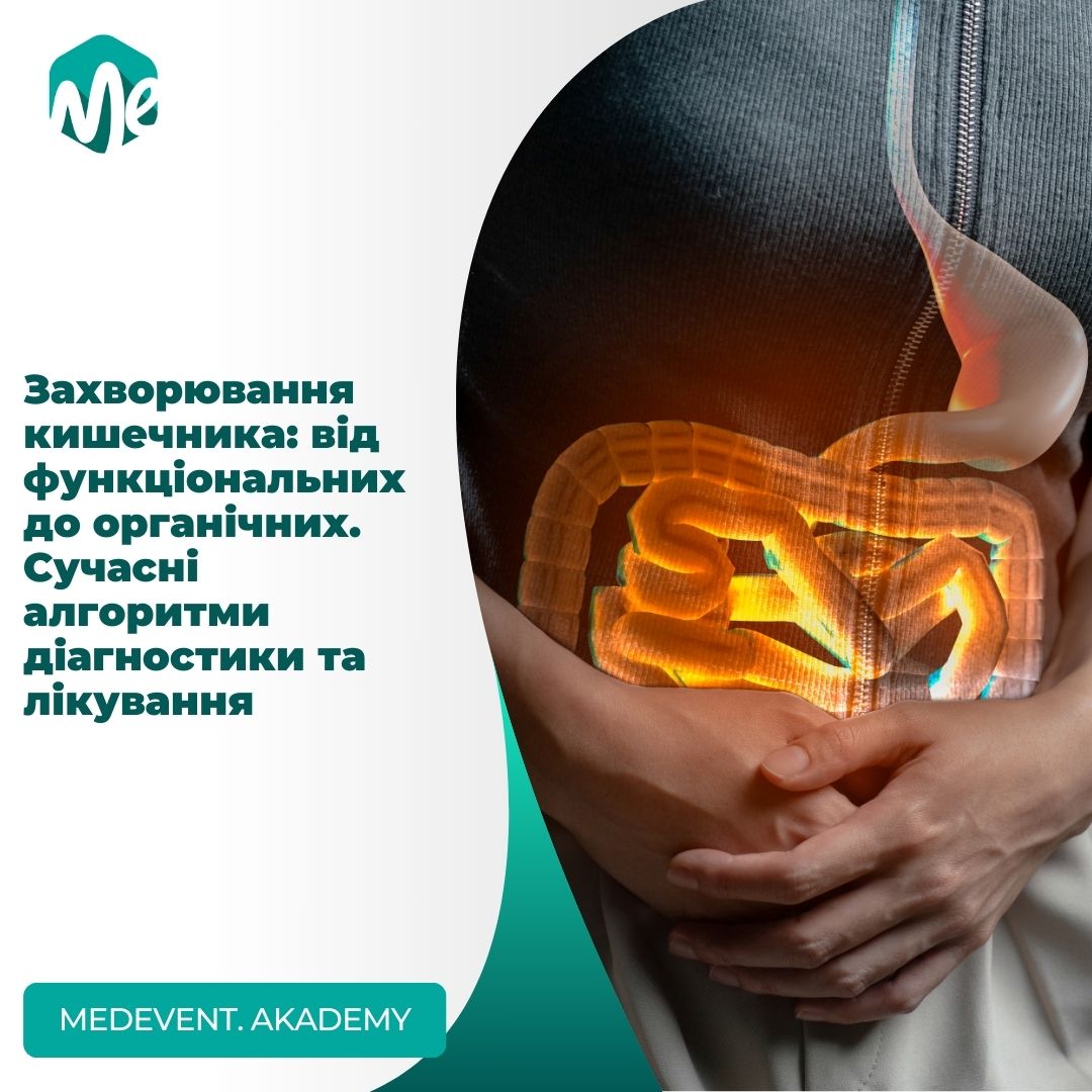 Захворювання кишечника: від функціональних до органічних. Сучасні алгоритми діагностики та лікування