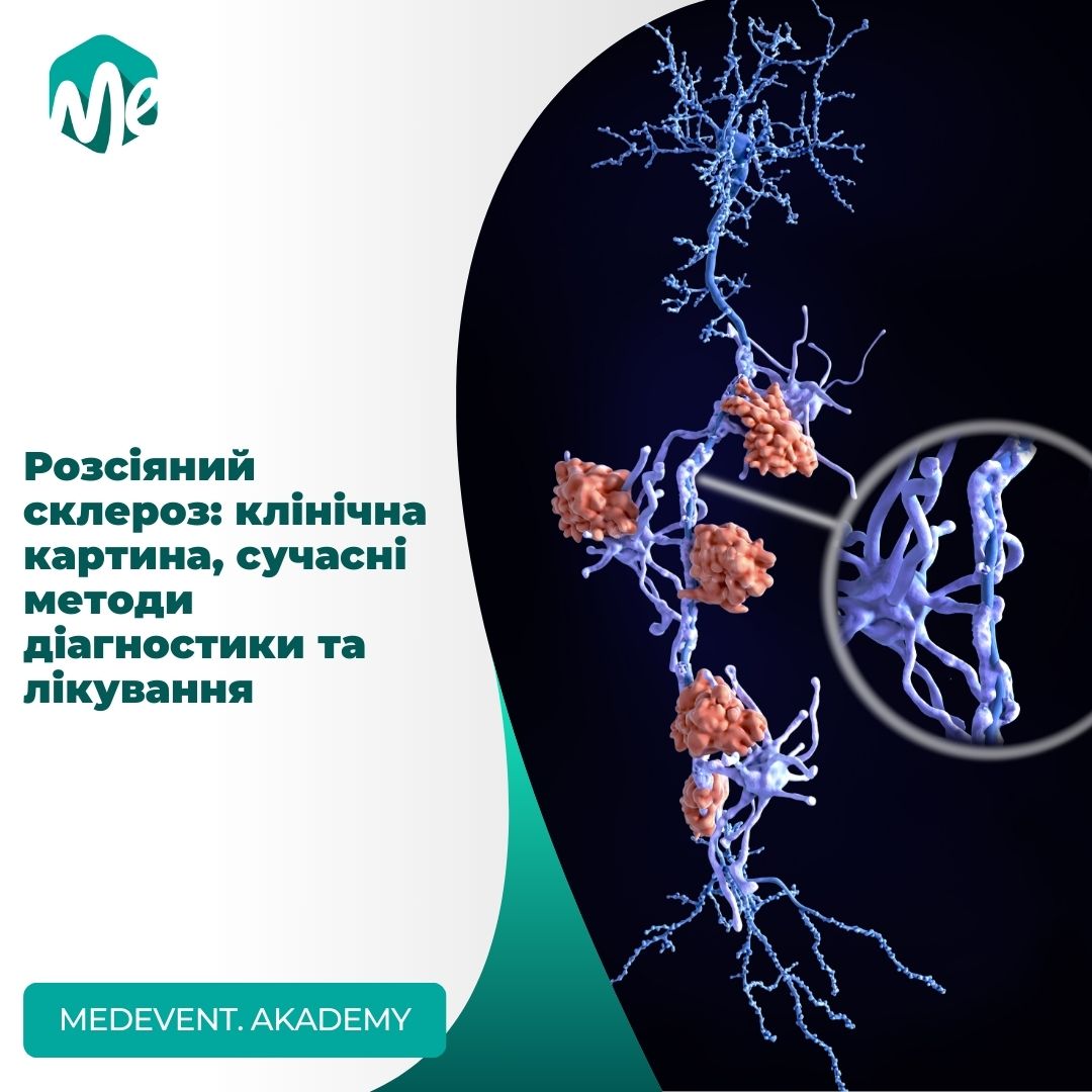 Розсіяний склероз: клінічна картина, сучасні методи діагностики та лікування