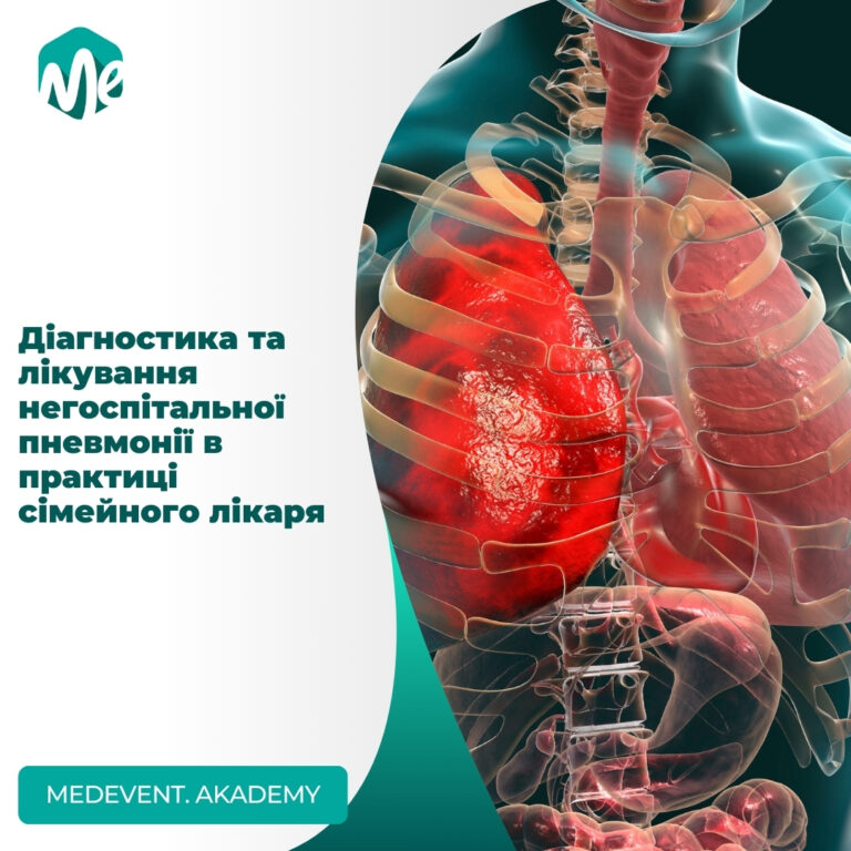 Діагностика та лікування негоспітальної пневмонії: доказові дані
