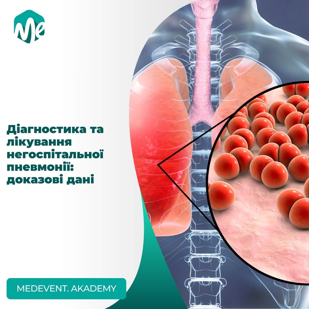 Діагностика та лікування негоспітальної пневмонії: доказові дані