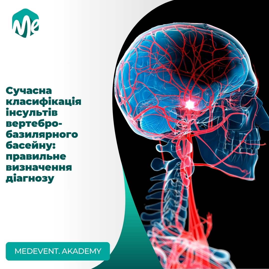 Сучасна класифікація інсультів вертебро-базилярного басейну: правильне визначення діагнозу