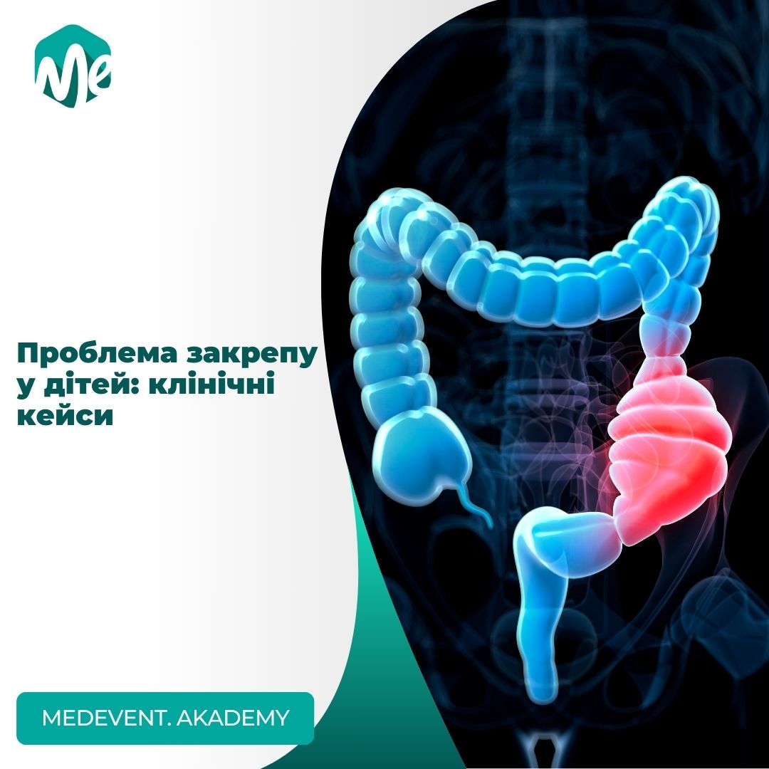 Проблема закрепу у дітей: клінічні кейси