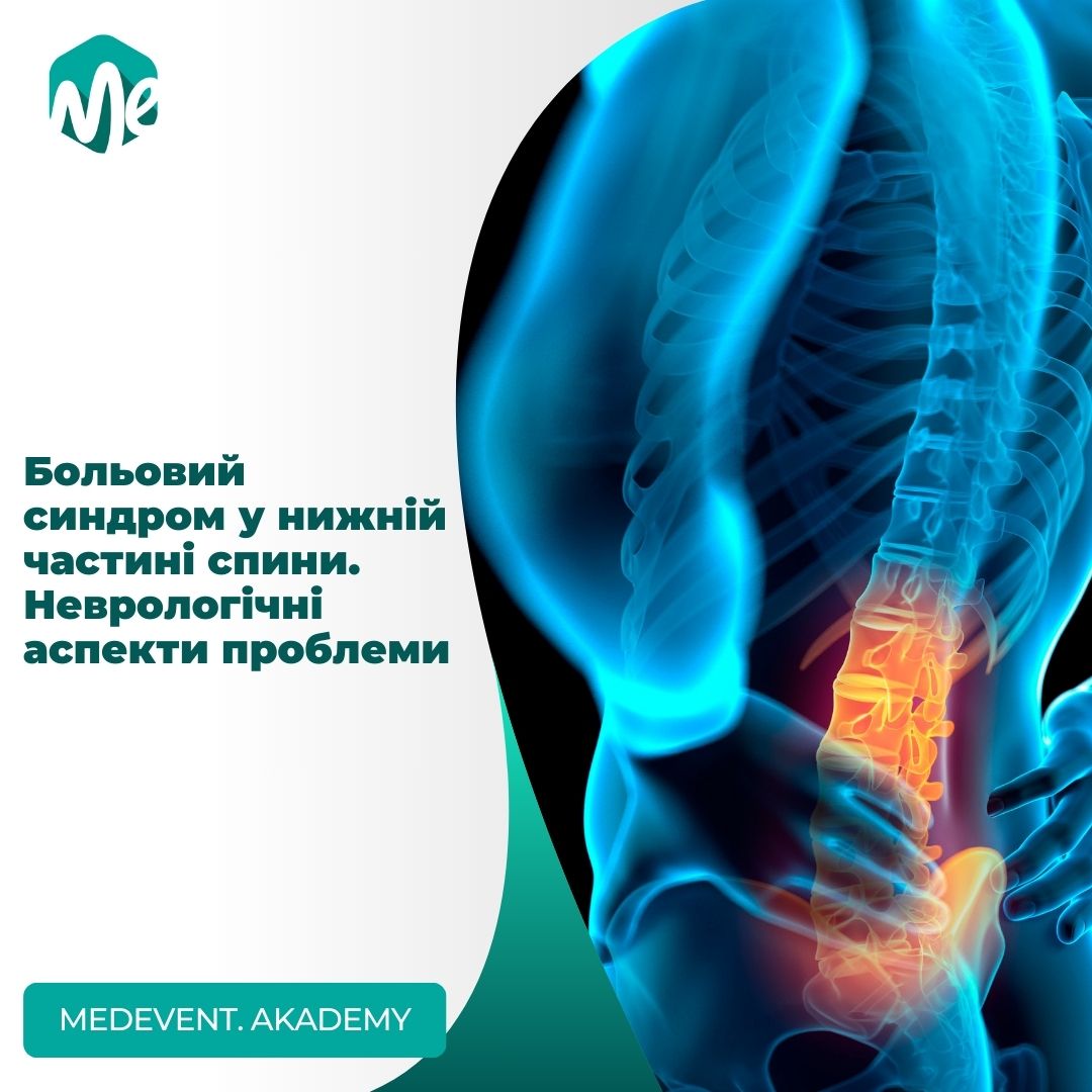 Больовий синдром у нижній частині спини. Неврологічні аспекти проблеми