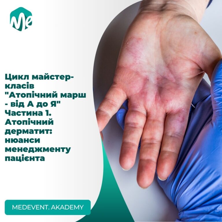 Атопічний дерматит: нюанси менеджменту пацієнта - атопічний марш - від а до я: частина 1