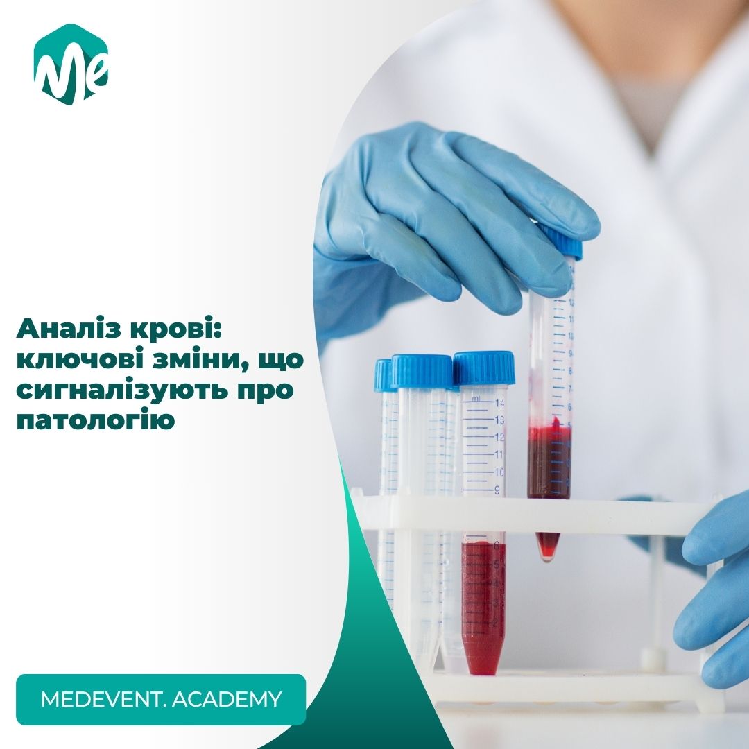 Аналіз крові: ключові зміни, що сигналізують про патологію