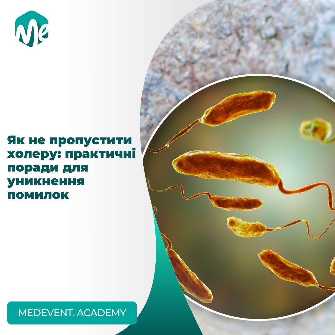 Як не пропустити холеру: практичні поради для уникнення помилок