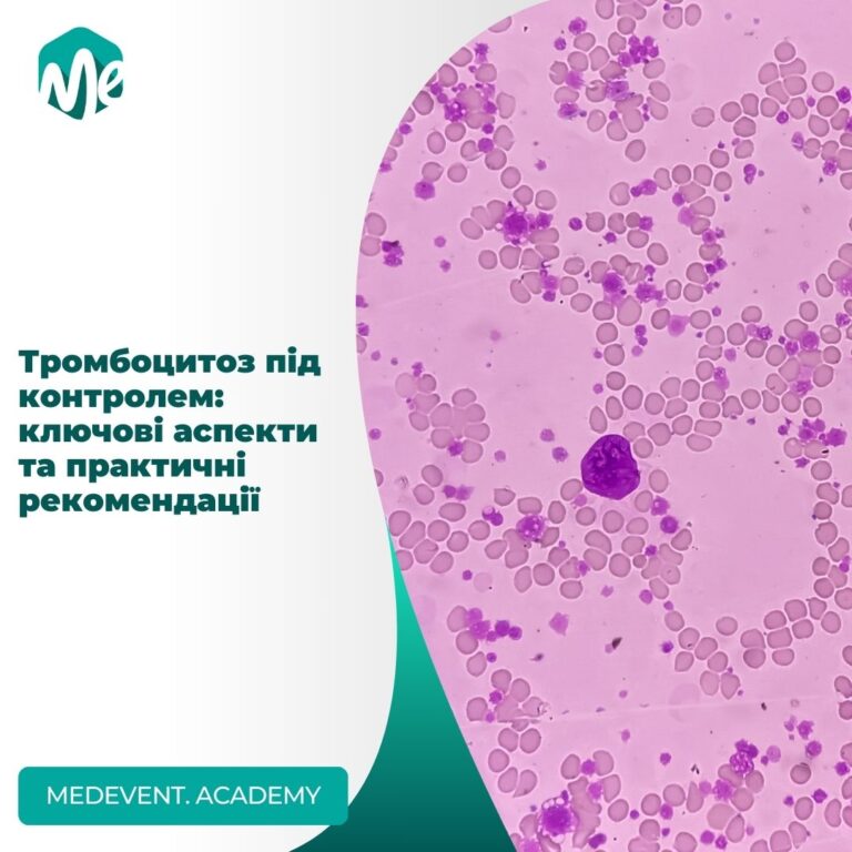 Тромбоцитоз під контролем