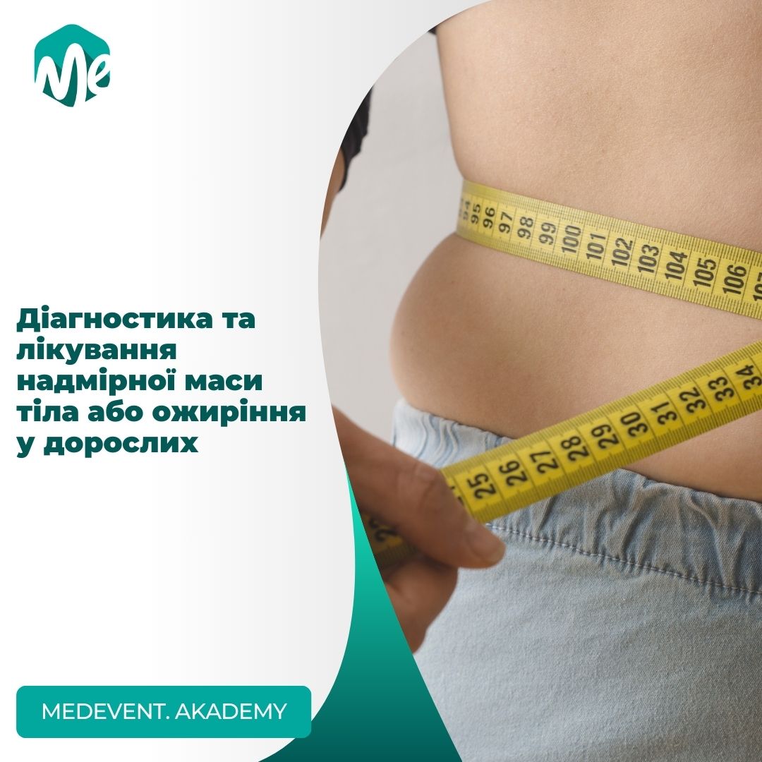 Діагностика та лікування надмірної маси тіла або ожиріння у дорослих