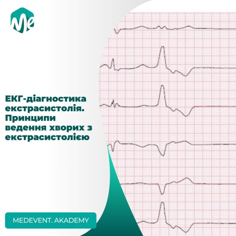 ЕКГ-діагностика екстрасистолія.  Принципи ведення хворих з екстрасистолією