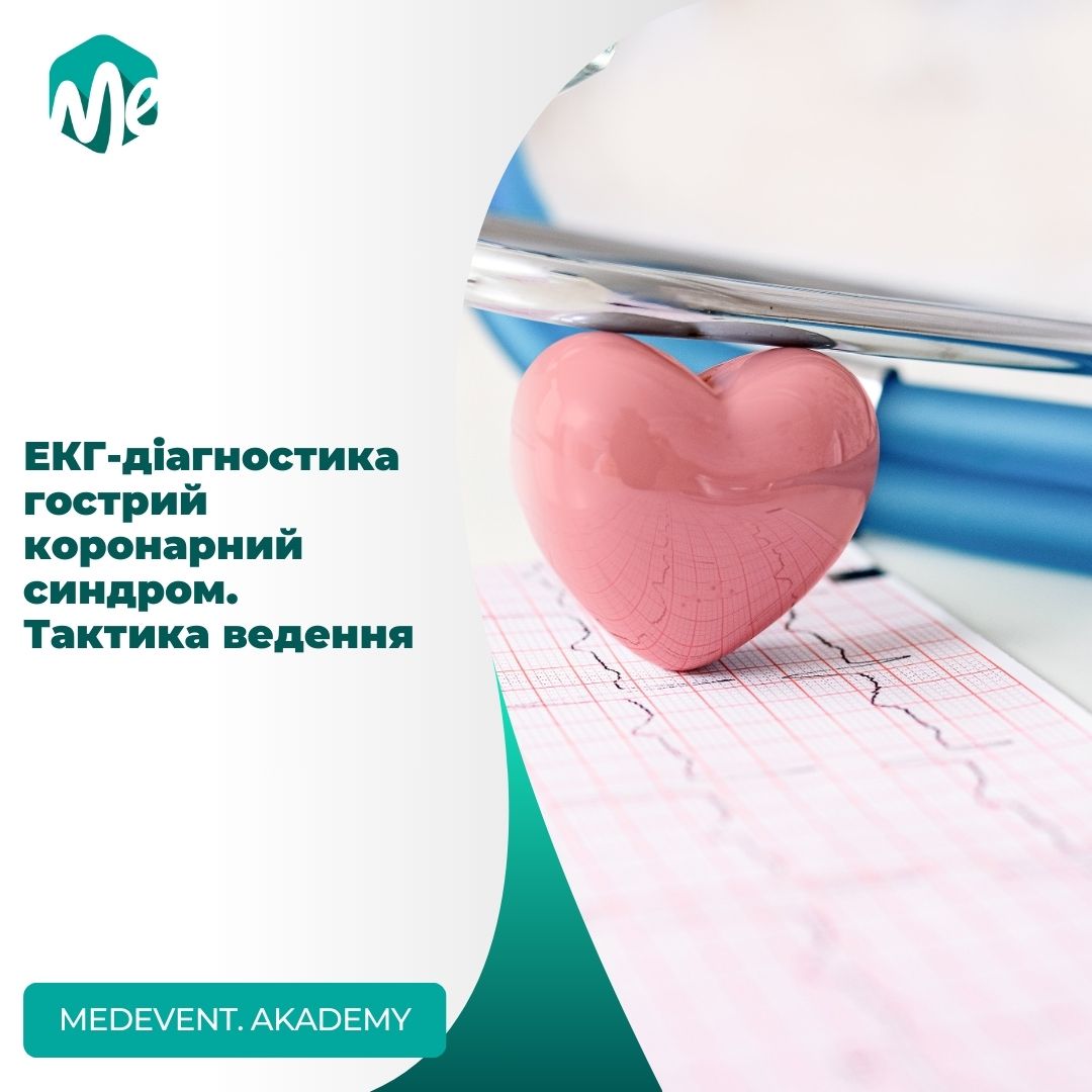 ЕКГ-діагностика гострий коронарний синдром. Тактика