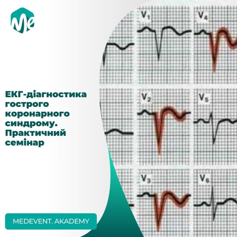 ЕКГ діагностика гострого коронарного синдрому. Практичний семінар