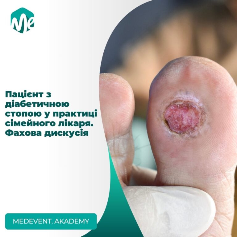 Пацієнт з діабетичною стопою у