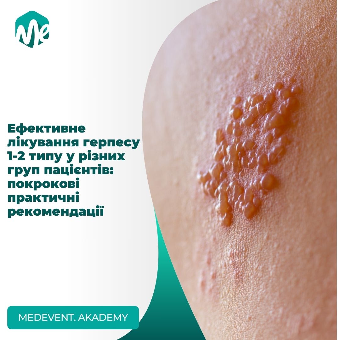 Ефективне лікування герпесу 1-2 типу у різних груп пацієнтів: покрокові практичні рекомендації