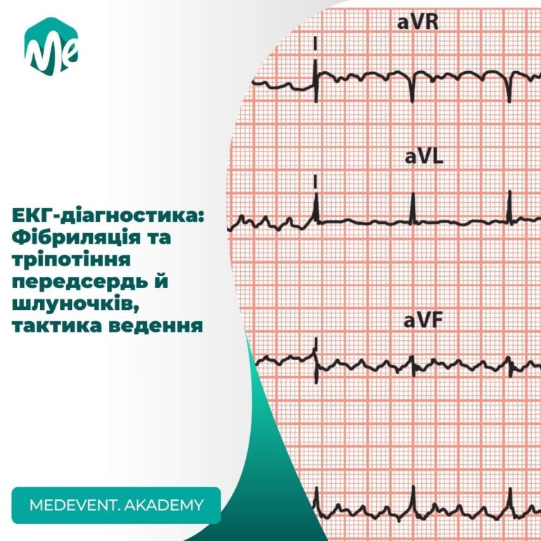 Екг-діагностика: фібриляція та тріпотіння передсердь