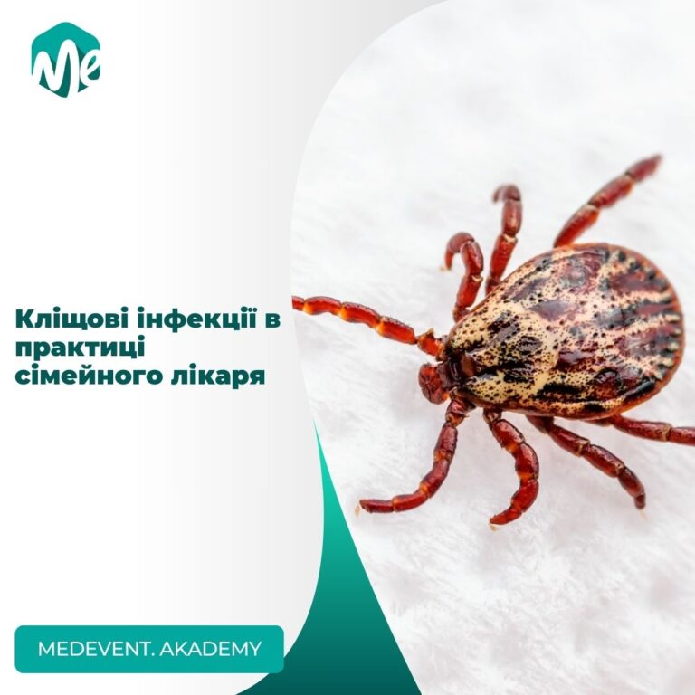 Кліщові інфекції в практиці сімейного