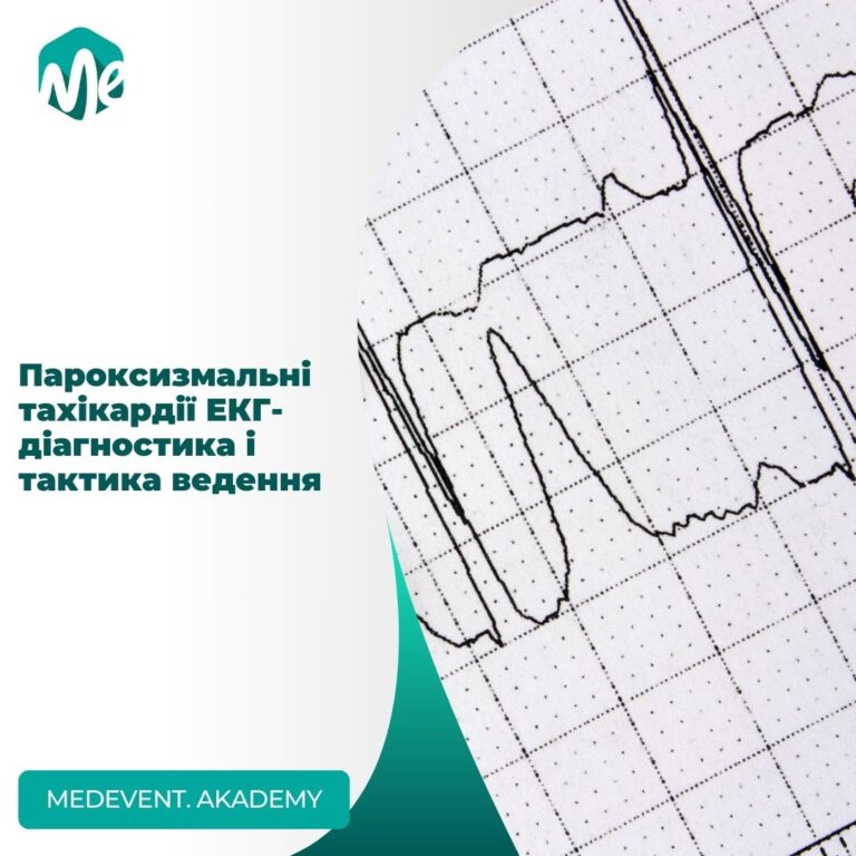 Пароксизмальні тахікардії: екг-діагностика і тактика