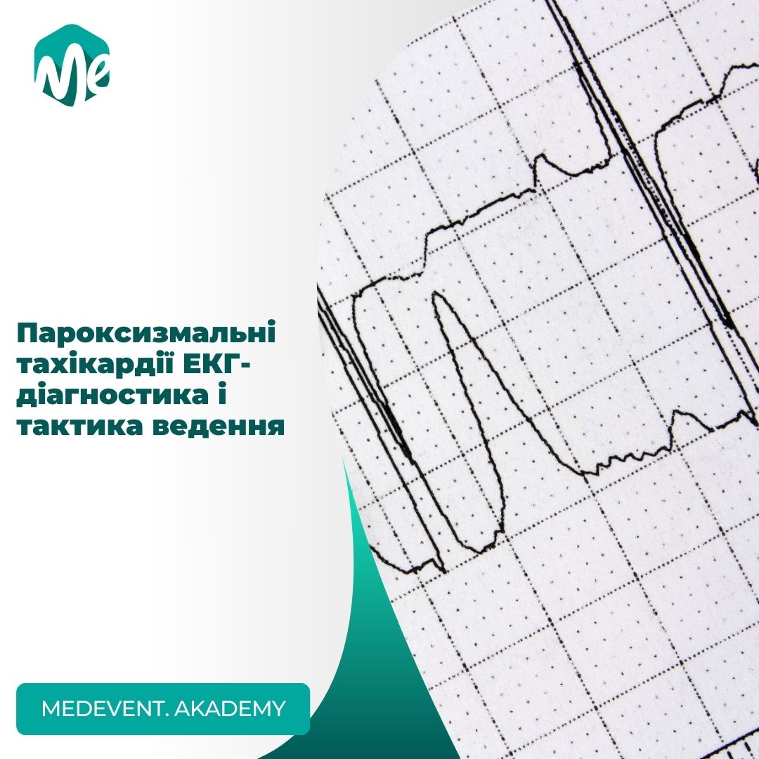 Пароксизмальні тахікардії: ЕКГ-діагностика і тактика
