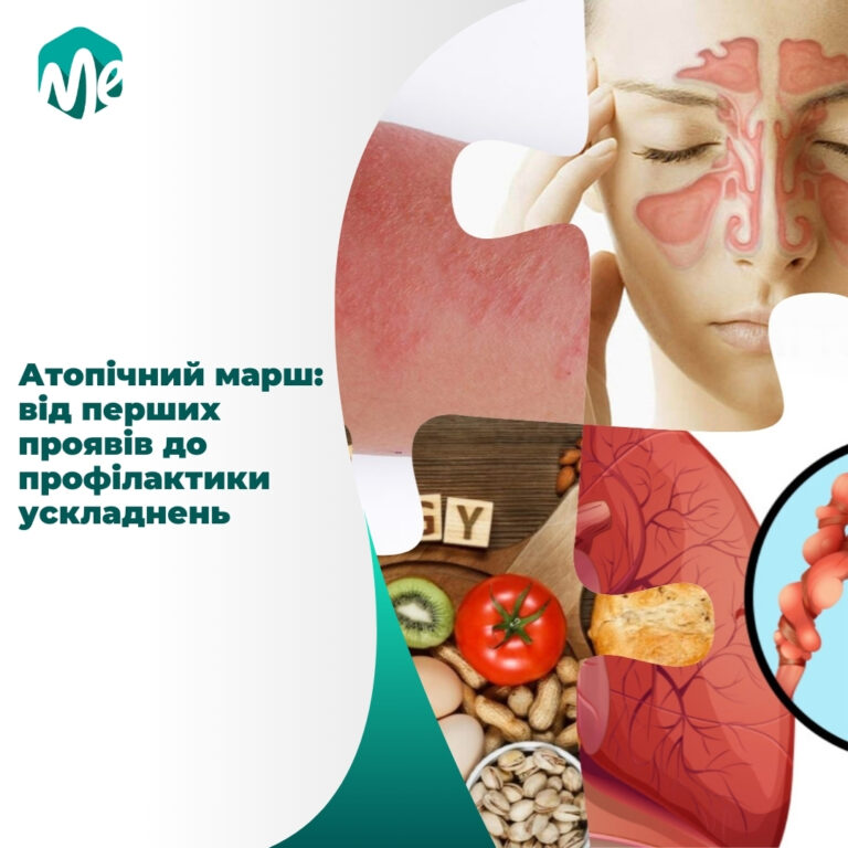 Атопічний марш: від перших проявів