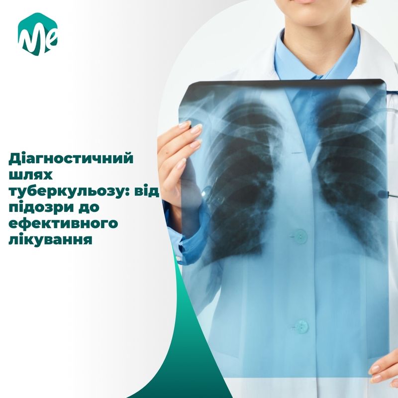 Діагностичний шлях туберкульозу: від підозри до ефективного лікування