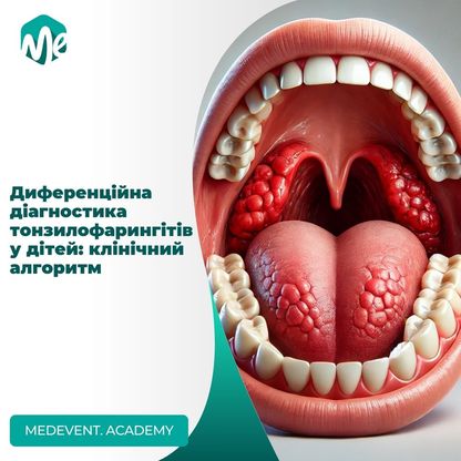 Диференційна діагностика тонзилофарингітів у дітей: клінічний алгоритм