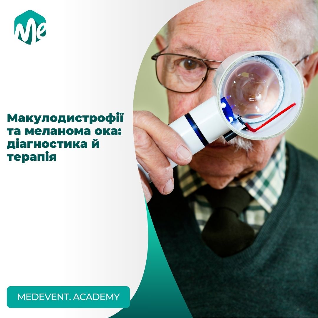 Макулодистрофії та меланома ока: діагностика й терапія