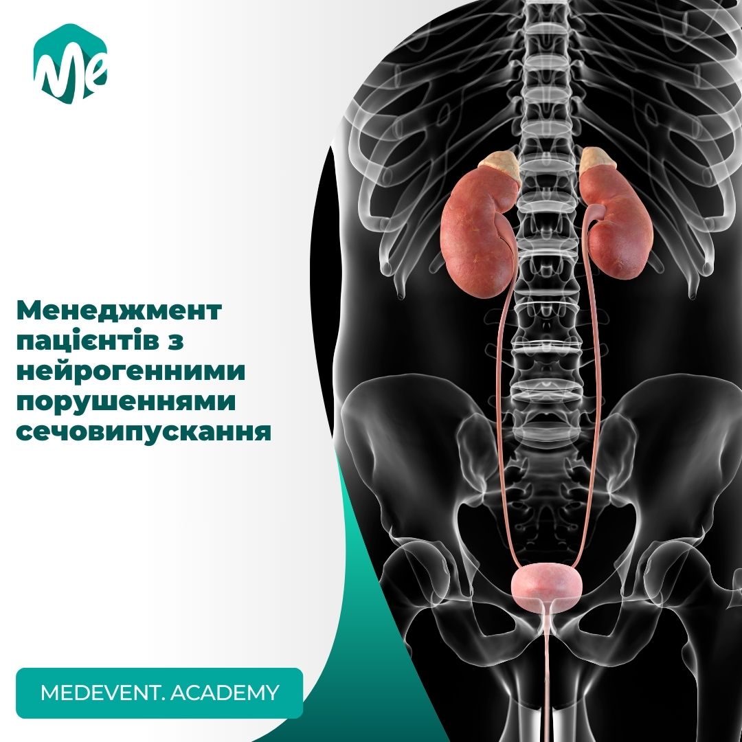 Менеджмент пацієнтів з нейрогенними порушеннями сечовипускання