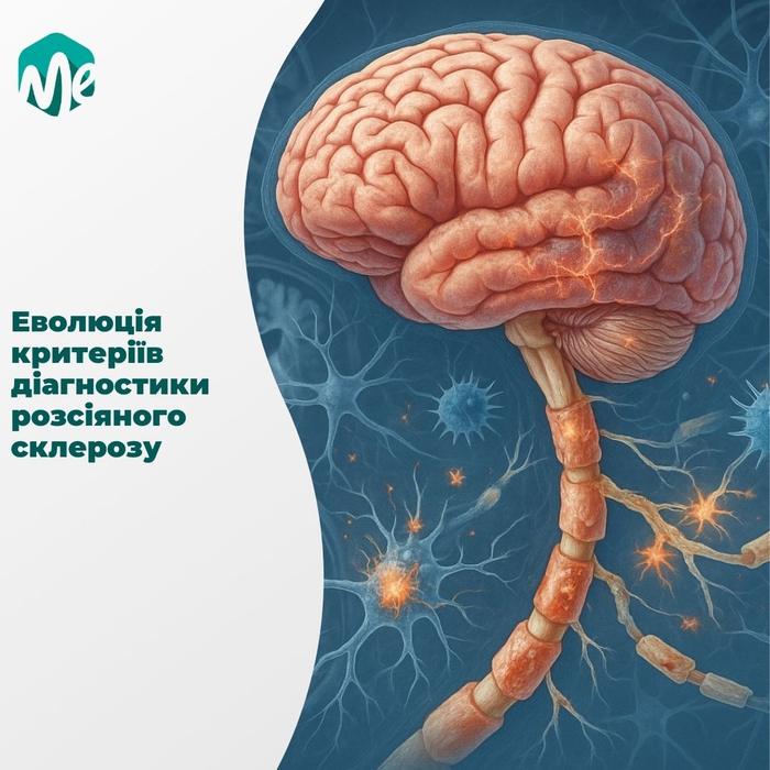 Еволюція критеріїв діагностики розсіяного склерозу