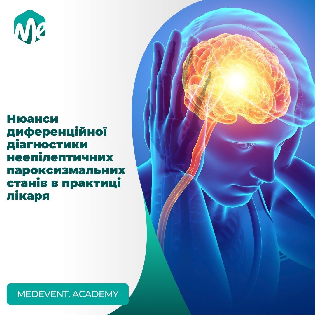 Нюанси диференційної діагностики неепілептичних пароксизмальних станів в практиці лікаря