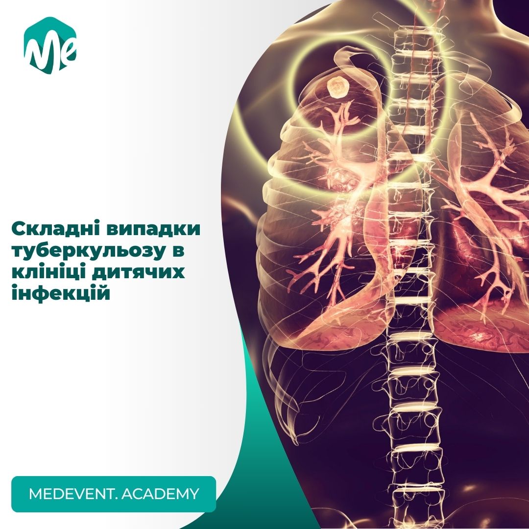 Складні випадки туберкульозу в клініці дитячих інфекцій