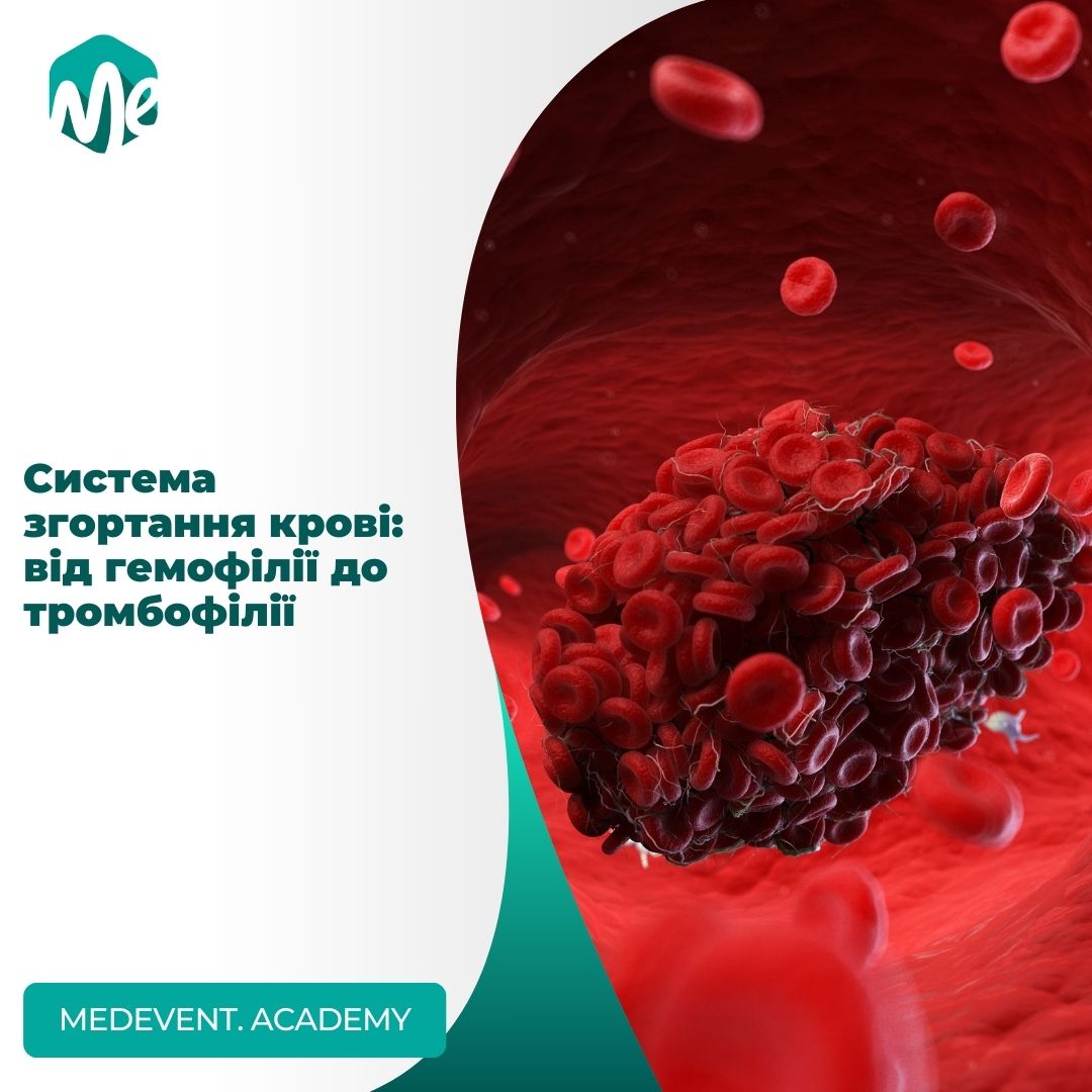 Система згортання крові: від гемофілії до тромбофілії